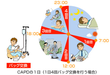 capd