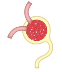 慢性腎炎